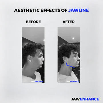 Jaw Enhance - Ultimate Facial Exerciser