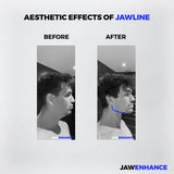 Jaw Enhance - Ultimate Facial Exerciser