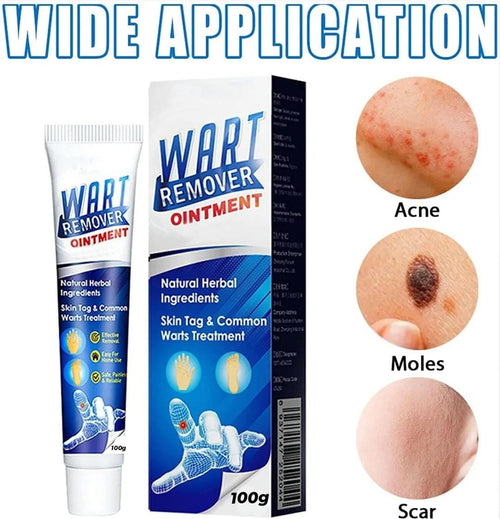 ATEMPORAL WARTS REMOVER CREAM ⭐️⭐️⭐️⭐️⭐️ (14758+ reviews)