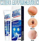 ATEMPORAL WARTS REMOVER CREAM ⭐️⭐️⭐️⭐️⭐️ (14758+ reviews)