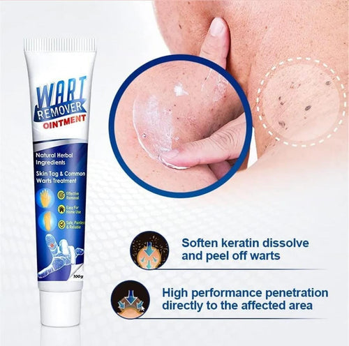 ATEMPORAL WARTS REMOVER CREAM ⭐️⭐️⭐️⭐️⭐️ (14758+ reviews)