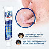 ATEMPORAL WARTS REMOVER CREAM ⭐️⭐️⭐️⭐️⭐️ (14758+ reviews)