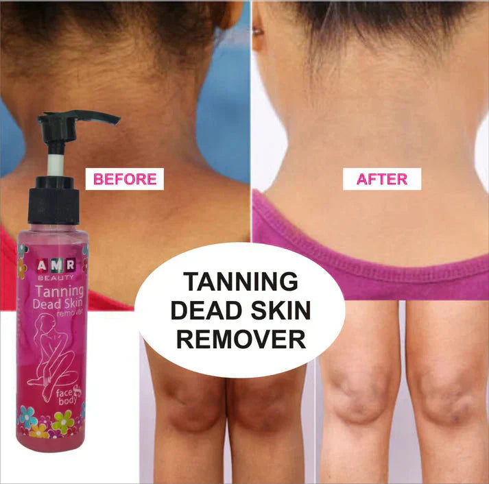 Yasme™️Tanning Dead Skin Remover (Pack of 2)